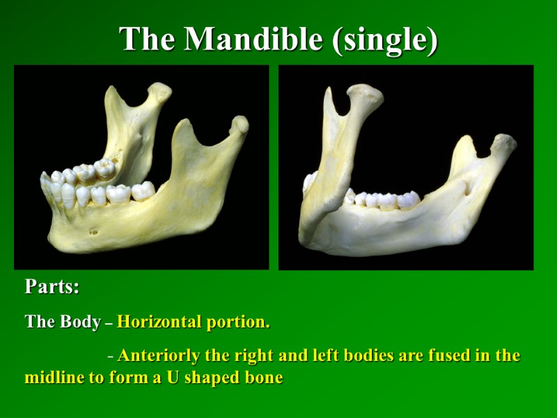 The Mandible (single)   Parts: The Body – Horizontal portion.   